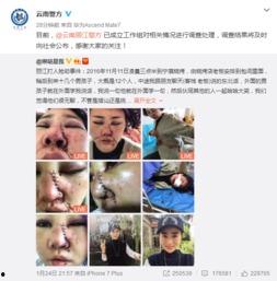 爆料博主毁容事件真相视频,爆料博主遭遇的惊人内幕 第2张 爆料博主毁容事件真相视频,爆料博主遭遇的惊人内幕 第2张